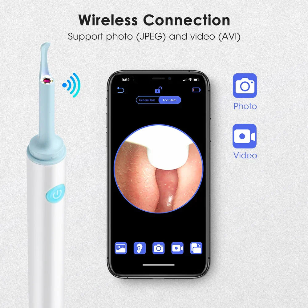 WW™ Ear Wax Removal Pro